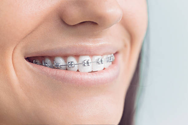 Best Wisdom Tooth Removal  in Buchanan, VA